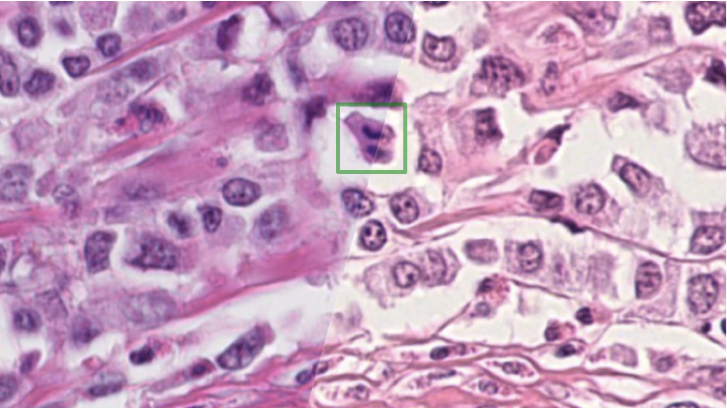 Breast cancer tissue, acquired using a Hamamatsu NanoZoomer XR (left, Scanner A) and a Hamamatsu NanoZoomer S360 (right, Scanner B).