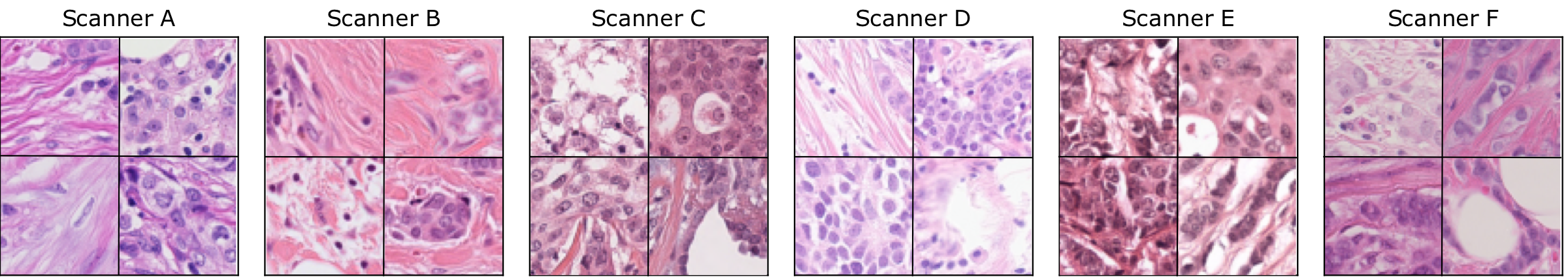 Random crops of breast cancer tissue from all six scanners of the training and test set, showing the visual variability between the scanners.
